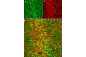 Immunohistochemistry (IHC) image for anti-Glutamate Receptor, Ionotropic, N-Methyl D-Aspartate 2B (GRIN2B) (Extracellular) antibody (ABIN7043230)