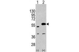 Image no. 1 for anti-Sprouty-Related, EVH1 Domain Containing 1 (SPRED1) (C-Term) antibody (ABIN356945) (SPRED1 抗体  (C-Term))