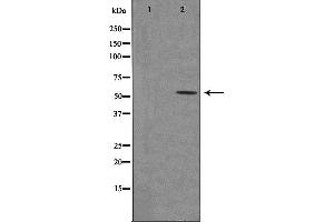 Western blot analysis of extracts from rat brain cells, using 5-HT-2C antibody. (HTR2C 抗体  (Internal Region))