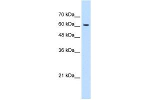 WB Suggested Anti-KIAA0319 Antibody Titration:  1. (KIAA0319 抗体  (N-Term))