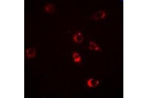 Immunofluorescent analysis of HSP47 staining in Hela cells.