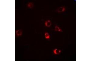 Immunofluorescent analysis of HSP47 staining in Hela cells. (SERPINH1 抗体)