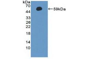 Detection of Recombinant CCNA1, Human using Polyclonal Antibody to Cyclin A1 (CCNA1) (Cyclin A1 抗体  (AA 183-430))