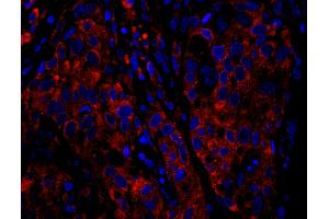 Immunofluorescence (IF) image for anti-Ribosomal Protein S6 (RPS6) (C-Term) antibody (ABIN7449016) (RPS6 抗体  (C-Term))