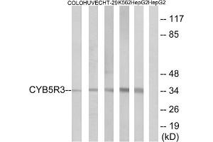 Western blot analysis of extracts from COLO cells, HUVEC cells, HT-29 cells, K562 cells and HepG2 cells, using CYB5R3 antibody. (CYB5R3 抗体  (Internal Region))
