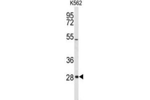 Western Blotting (WB) image for anti-Claudin 18 (CLDN18) (AA 231-259) antibody (ABIN3004093) (Claudin 18 抗体  (AA 231-259))