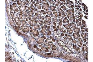 Immunohistochemistry (IHC) image for anti-NADH Dehydrogenase (Ubiquinone) Fe-S Protein 3, 30kDa (NADH-Coenzyme Q Reductase) (NDUFS3) (Center) antibody (ABIN2856200)