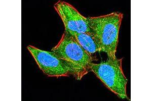 Immunofluorescence (IF) image for anti-Homeobox A9 (HOXA9) (AA 1-272) antibody (ABIN5542329)