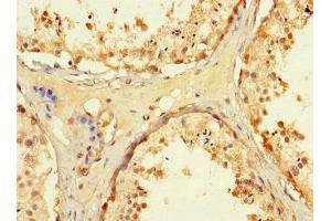 Immunohistochemistry of paraffin-embedded human testis tissue using ABIN7171480 at dilution of 1:100 (WRB 抗体  (AA 38-99))