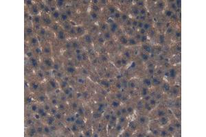Used in DAB staining on fromalin fixed paraffin- embedded Kidney tissue (EIF2D 抗体  (AA 360-570))