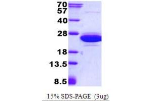 Image no. 1 for Cannabinoid Receptor Interacting Protein 1 (Cnrip1) protein (His tag) (ABIN5780765) (Cnrip1 Protein (His tag))