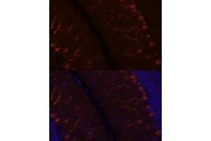 Immunofluorescence analysis of rat brain using K antibody (ABIN7268068) at dilution of 1:100. (KAL1 抗体  (AA 200-300))