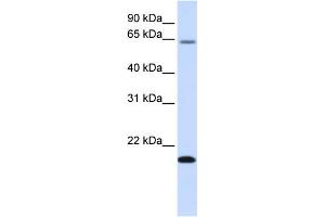 WB Suggested Anti-FAM19A3 Antibody Titration:  0. (FAM19A3 抗体  (Middle Region))