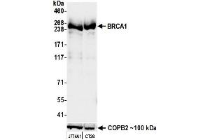 Western Blotting (WB) image for anti-Breast Cancer 1 (BRCA1) (AA 525-575) antibody (ABIN7795735) (Recombinant BRCA1 抗体  (AA 525-575))