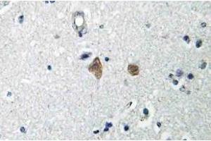 Immunohistochemistry (IHC) analyzes of mTOR antibody in paraffin-embedded human brain tissue. (MTOR 抗体  (pSer2448))