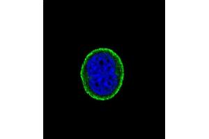 Confocal immunofluorescent analysis of IL10RA Antibody (Center) (ABIN652714 and ABIN2842473) with MCF-7 cell followed by Alexa Fluor® 488-conjugated goat anti-rabbit lgG (green). (IL-10RA 抗体  (AA 147-175))