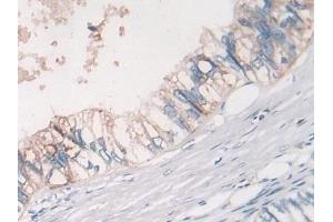 Immunohistochemistry (IHC) image for anti-Myostatin (MSTN) (AA 267-375) antibody (ABIN7433885)