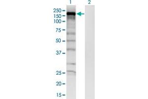 Western Blot analysis of SKIV2L expression in transfected 293T cell line by SKIV2L monoclonal antibody (M05), clone 1E5. (SKIV2L 抗体  (AA 1125-1233))