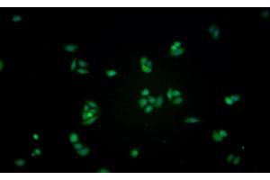 Detection of GLa in Human MCF7 cell using Monoclonal Antibody to Galactosidase Alpha (GLa) (GLA 抗体  (AA 81-429))