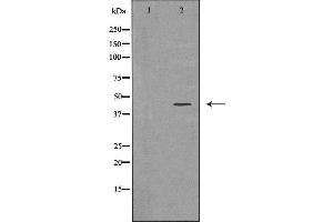 Western blot analysis of extracts of Y79, using ADIPOR1 antibody. (Adiponectin Receptor 1 抗体  (C-Term))