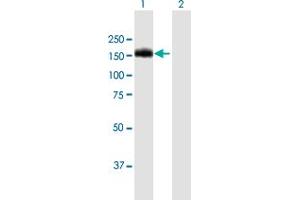 Western Blot analysis of BCR expression in transfected 293T cell line by BCR MaxPab polyclonal antibody. (BCR 抗体  (AA 1-1076))