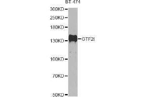 Western blot analysis of extracts of BT-474 cells, using GTF2I antibody (ABIN5995399) at 1/500 dilution. (GTF2I 抗体)