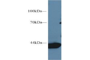 Western Blotting (WB) image for anti-Glutamic-Oxaloacetic Transaminase 1, Soluble (Aspartate Aminotransferase 1) (GOT1) (AA 1-413) antibody (ABIN7426220)