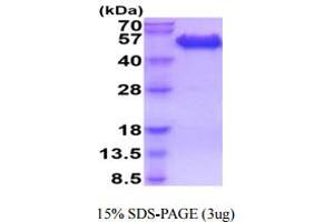 SDS-PAGE (SDS) image for CD99 (CD99) (AA 23-122) protein (hIgG-His-tag) (ABIN5854927) (CD99 Protein (CD99) (AA 23-122) (hIgG-His-tag))
