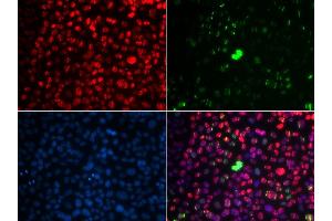 Immunofluorescence analysis of U2OS cells using Phospho-ATM-S1981 antibody (ABIN5969871). (ATM 抗体  (pSer1981))