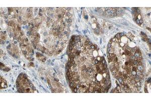 ABIN6276838 at 1/100 staining Human prostate tissue by IHC-P. (TLR5 抗体  (C-Term))