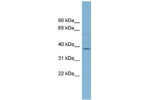 WB Suggested Anti-B3GALNT1 Antibody Titration:  0. (B3GALNT1 抗体  (Middle Region))