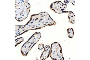 IHC analysis of SNRNP200 using anti-SNRNP200 antibody (ABIN7602032). (SNRNP200 抗体  (AA 557-2129))