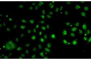 Immunofluorescence analysis of A-549 cells using LDLRAP1 Polyclonal Antibody