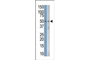 Image no. 1 for anti-serine/threonine Kinase 38 Like (STK38L) (C-Term) antibody (ABIN360006) (STK38L 抗体  (C-Term))