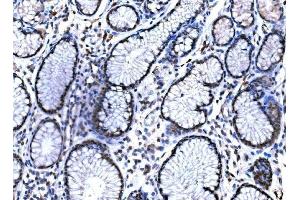IHC analysis of KAT3B/P300/EP300 using anti-KAT3B/P300/EP300 antibody (ABIN7603064).