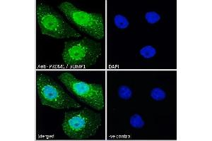 ABIN570911 Immunofluorescence analysis of paraformaldehyde fixed A431 cells, permeabilized with 0. (PRDM1 抗体  (C-Term))