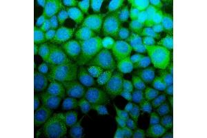 IF analysis of ASS1 using anti-ASS1 antibody (ABIN7601191). (ASS1 抗体  (AA 3-365))