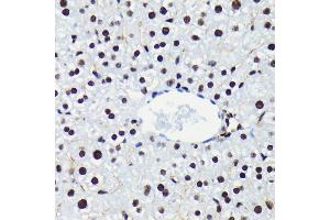 Immunohistochemistry of paraffin-embedded mouse liver using Phospho-Rb-S780 antibody (ABIN7269936) at dilution of 1:100 (40x lens). (Retinoblastoma 1 抗体  (pSer780))
