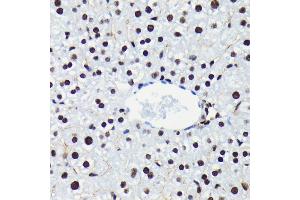 Immunohistochemistry of paraffin-embedded mouse liver using Phospho-Rb-S780 antibody (ABIN7269936) at dilution of 1:100 (40x lens). (Retinoblastoma 1 抗体  (pSer780))