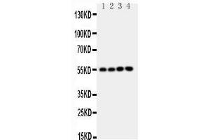 Anti-NRF1 antibody, Western blotting Lane 1: Rat Brain Tissue Lysate Lane 2: Rat Kidney Tissue Lysate Lane 3: MCF-7 Cell Lysate Lane 4: A549 Cell Lysate (NRF1 抗体  (Middle Region))