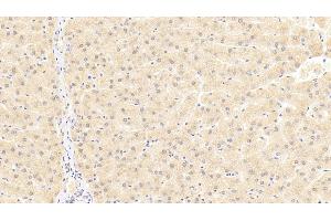 Detection of TRAF6 in Human Liver Tissue using Polyclonal Antibody to TNF Receptor Associated Factor 6 (TRAF6) (TRAF6 抗体  (AA 153-423))