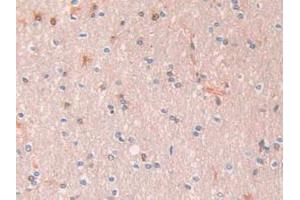 IHC-P analysis of Human Liver Tissue, with DAB staining. (SERPINA1 抗体  (AA 25-418))