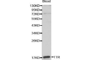 TTR Antikörper  (AA 21-147)