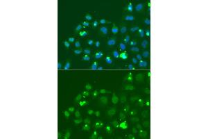 Immunofluorescence analysis of A549 cells using ATF3 antibody (ABIN6290025). (ATF3 抗体)