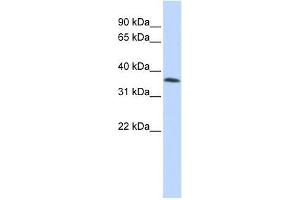 C8orf70 antibody used at 2. (FAM164A 抗体  (Middle Region))