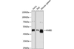 Western blot analysis of extracts of various cell lines, using HMBS antibody (ABIN3022529, ABIN3022530, ABIN3022531 and ABIN6218882) at 1:1000 dilution. (HMBS 抗体  (AA 1-361))