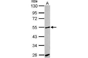 WB Image Sample (30 ug of whole cell lysate) A: BCL-1 10% SDS PAGE antibody diluted at 1:1000 (ACVRL1 抗体  (C-Term))