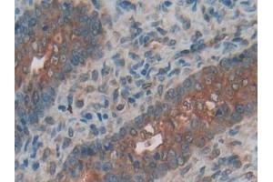 DAB staining on IHC-P; Samples: Rat Ovary Tissue