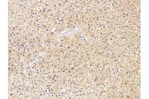 Detection of CLDN1 in Human Liver Tissue using Polyclonal Antibody to Claudin 1 (CLDN1) (Claudin 1 抗体  (AA 50-197))