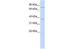 WB Suggested Anti-ZNF264 Antibody Titration:  0. (ZNF264 抗体  (N-Term))